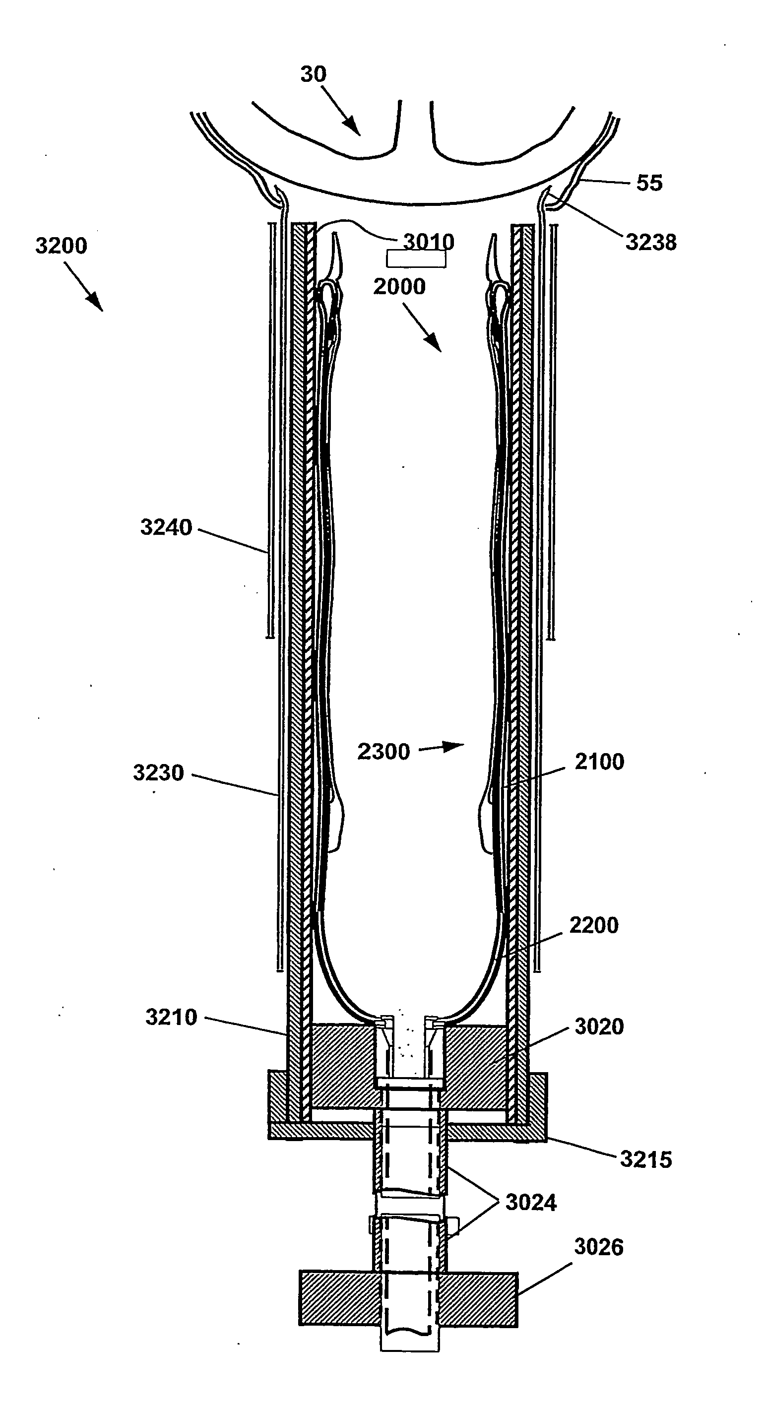 Method and Apparatus for Minimally Invasive Direct Mechanical Ventricular Actuation