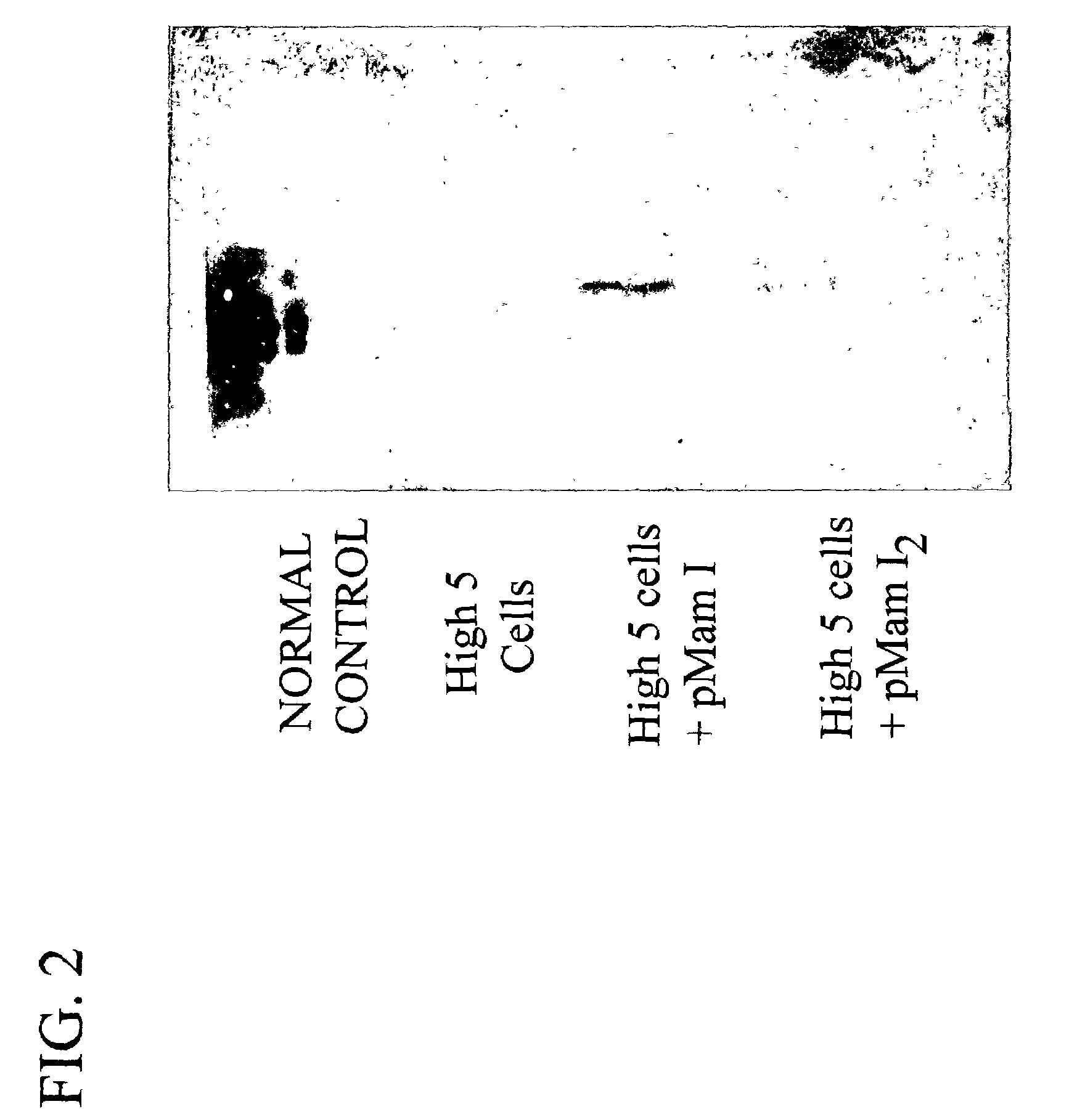 Methods and compositions for diagnosing breast cancer