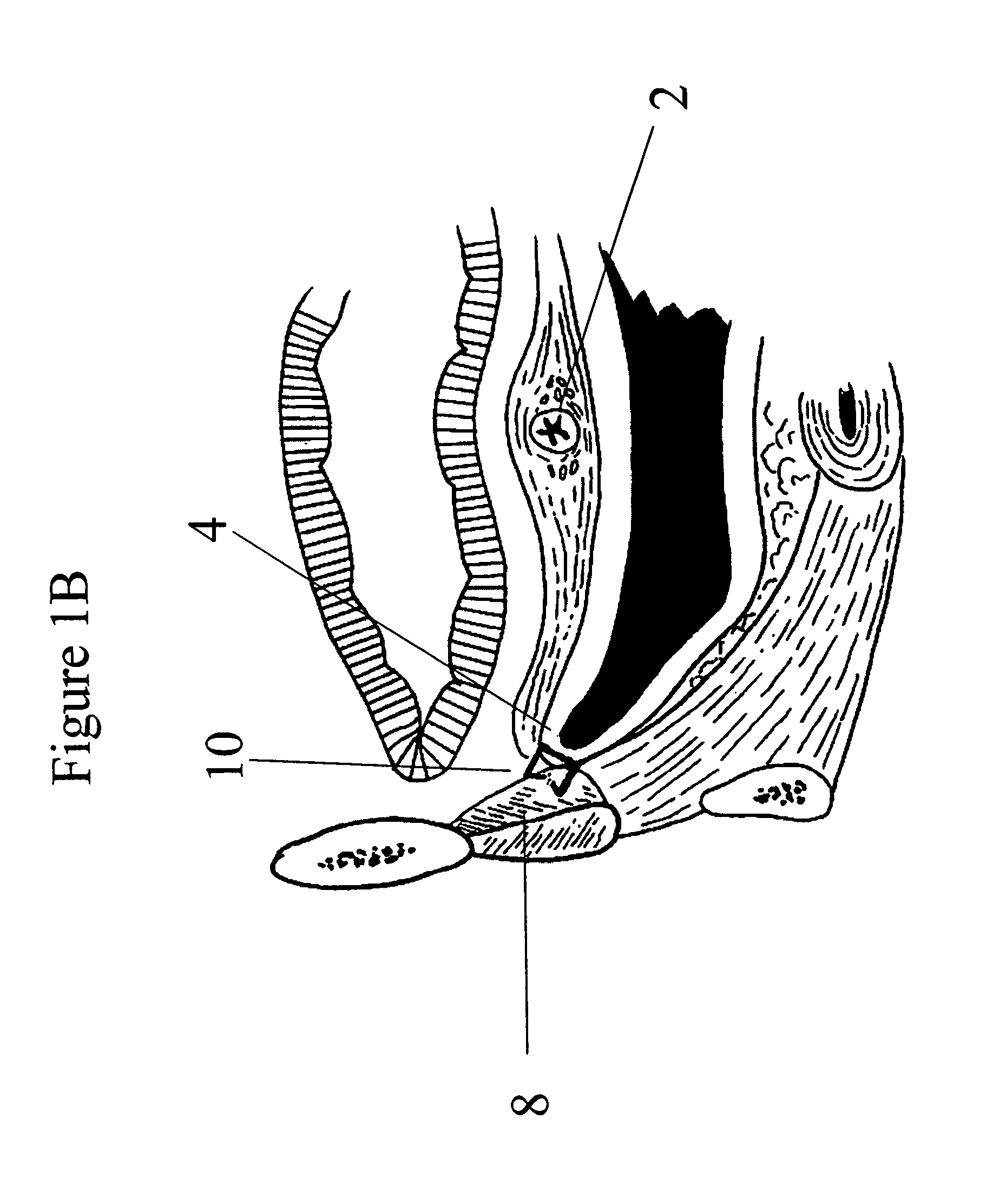 System and methods for soft tissue reconstruction