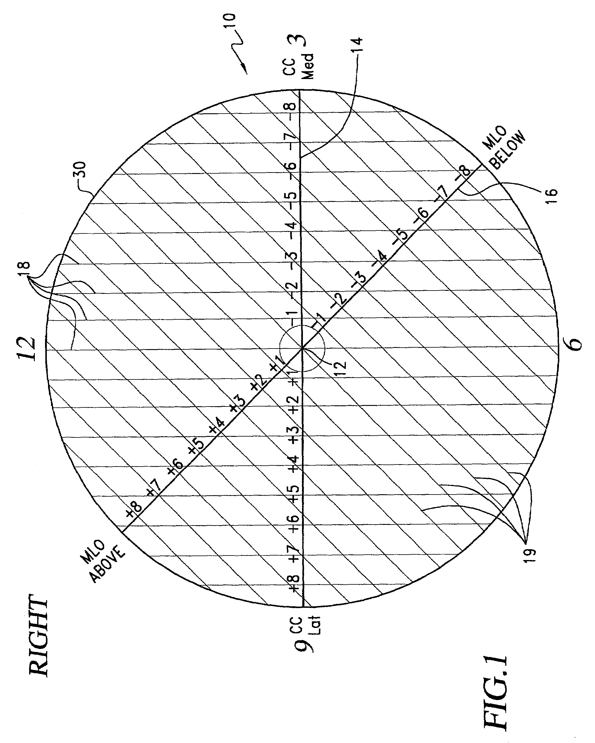 Template for the localization of lesions in a breast and method of use thereof