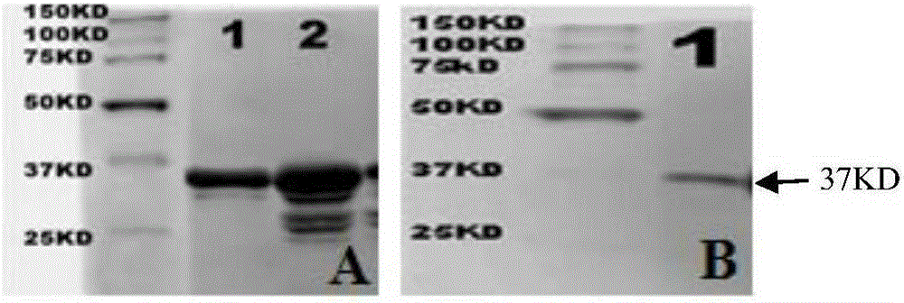 Polypeptide used for preventing and treating enteropathogenic Escherichia coli infection