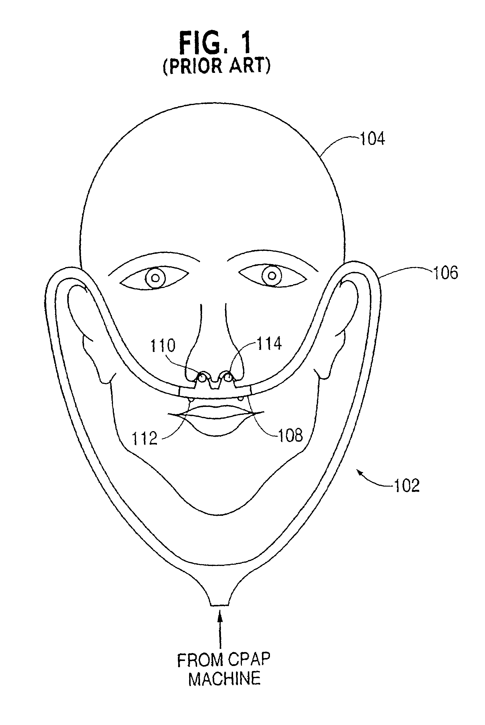 Nasal gas delivery system and method for use thereof