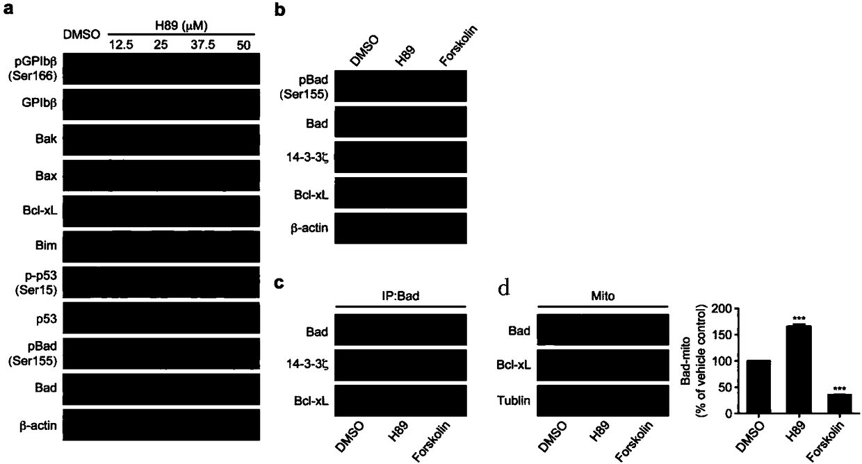 Use of protein kinase A inhibitor in preparation of medicament for treating diseases related to increase of number of platelets