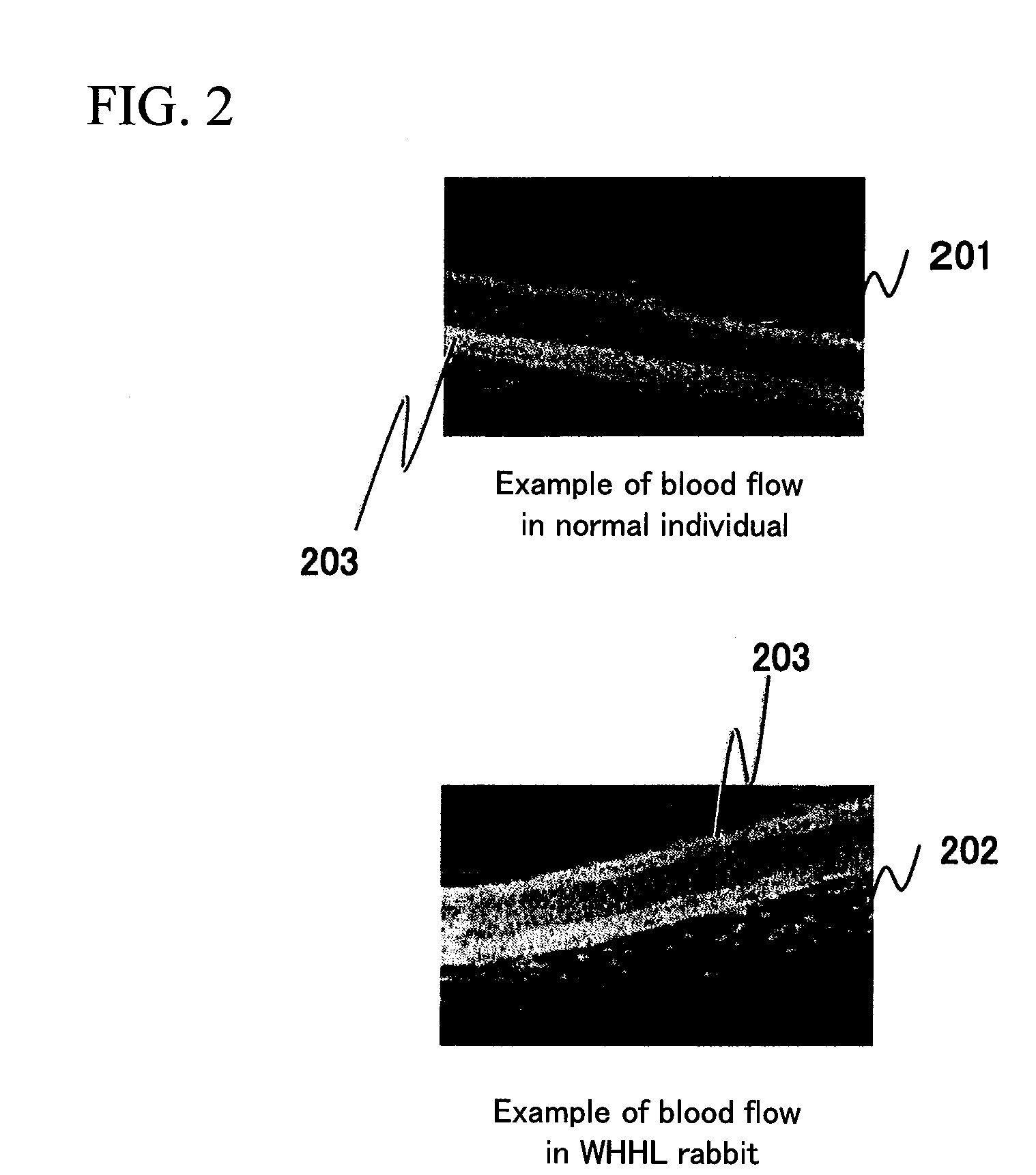 Blood flow measuring and evaluating apparatus