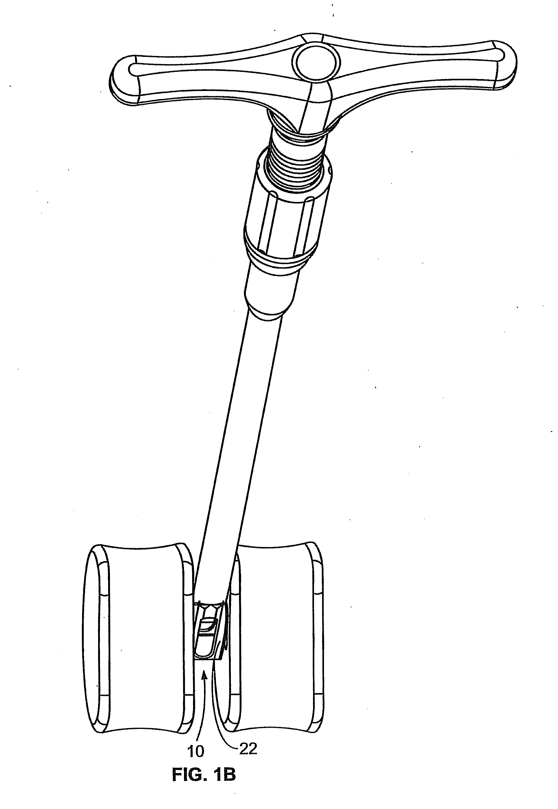 Methods and Systems for Interbody Implant and Bone Graft Delivery