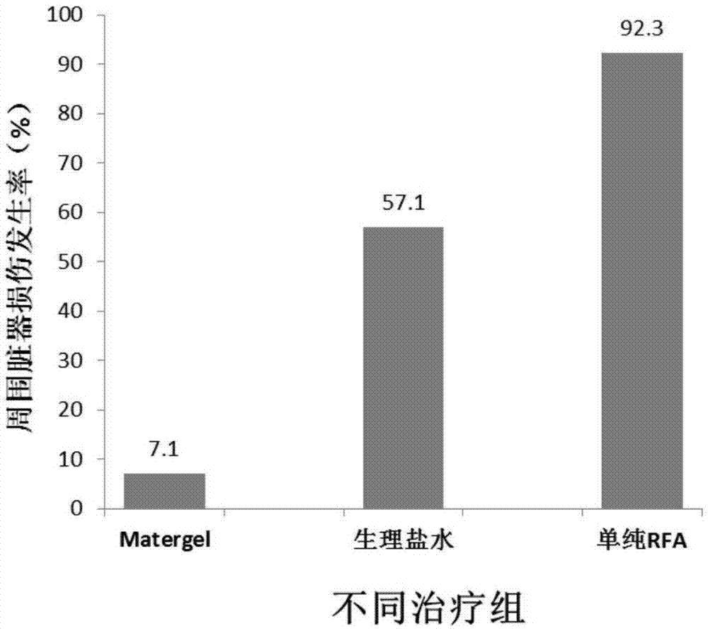 Application of thermosensitive material in preparation of injection for protecting organ peripheral structure in thermal ablation