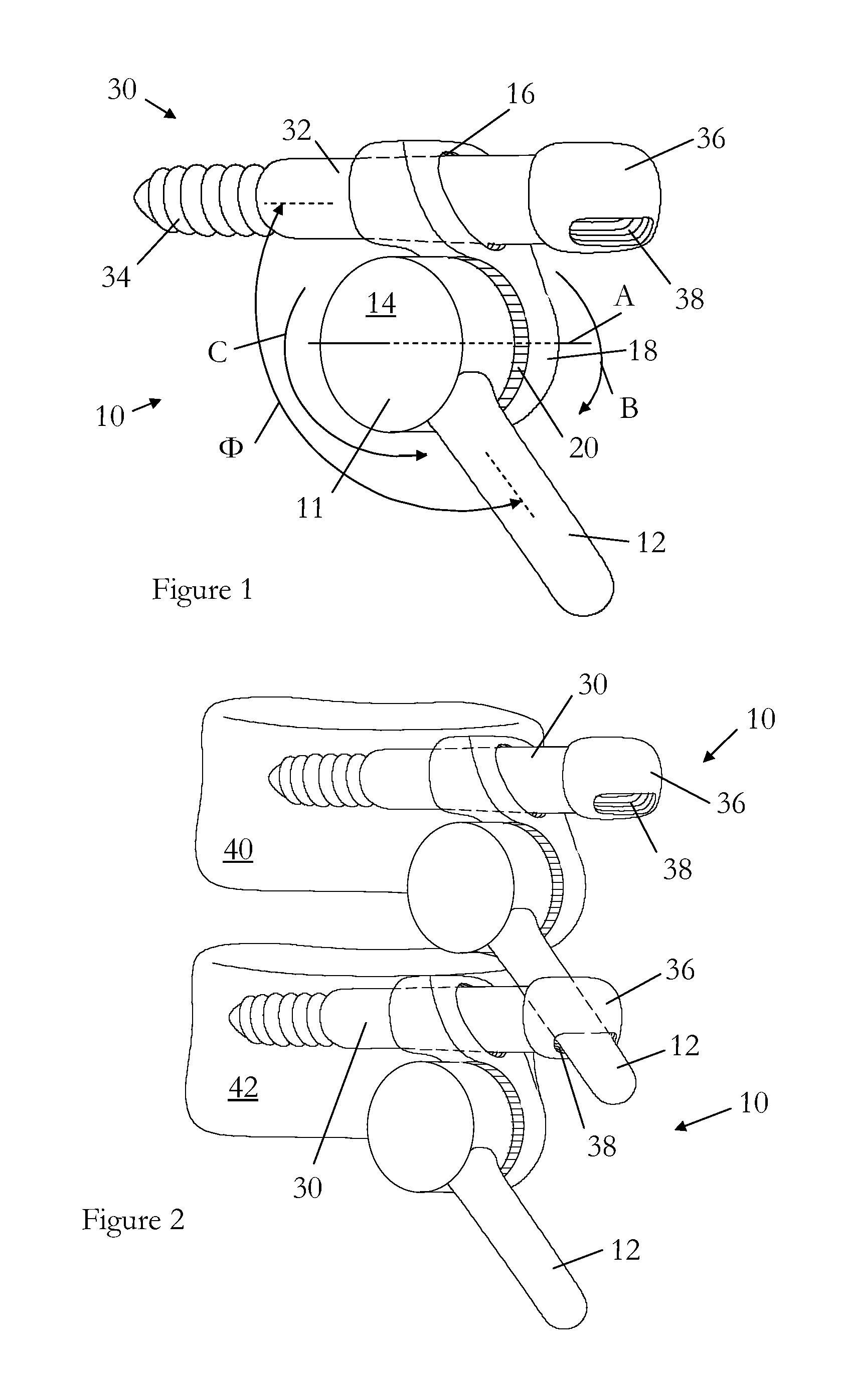 Surgical device for correction of spinal deformities