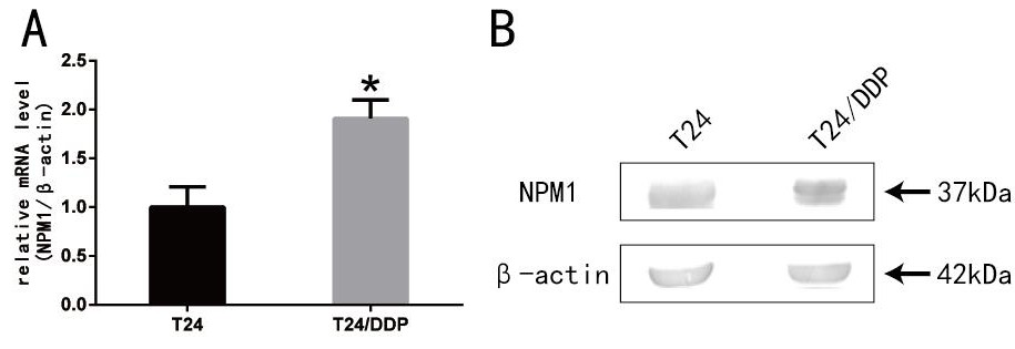 An npm1 knockout human bladder cancer t24/ddp cell line