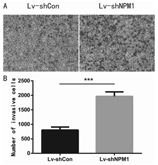 An npm1 knockout human bladder cancer t24/ddp cell line