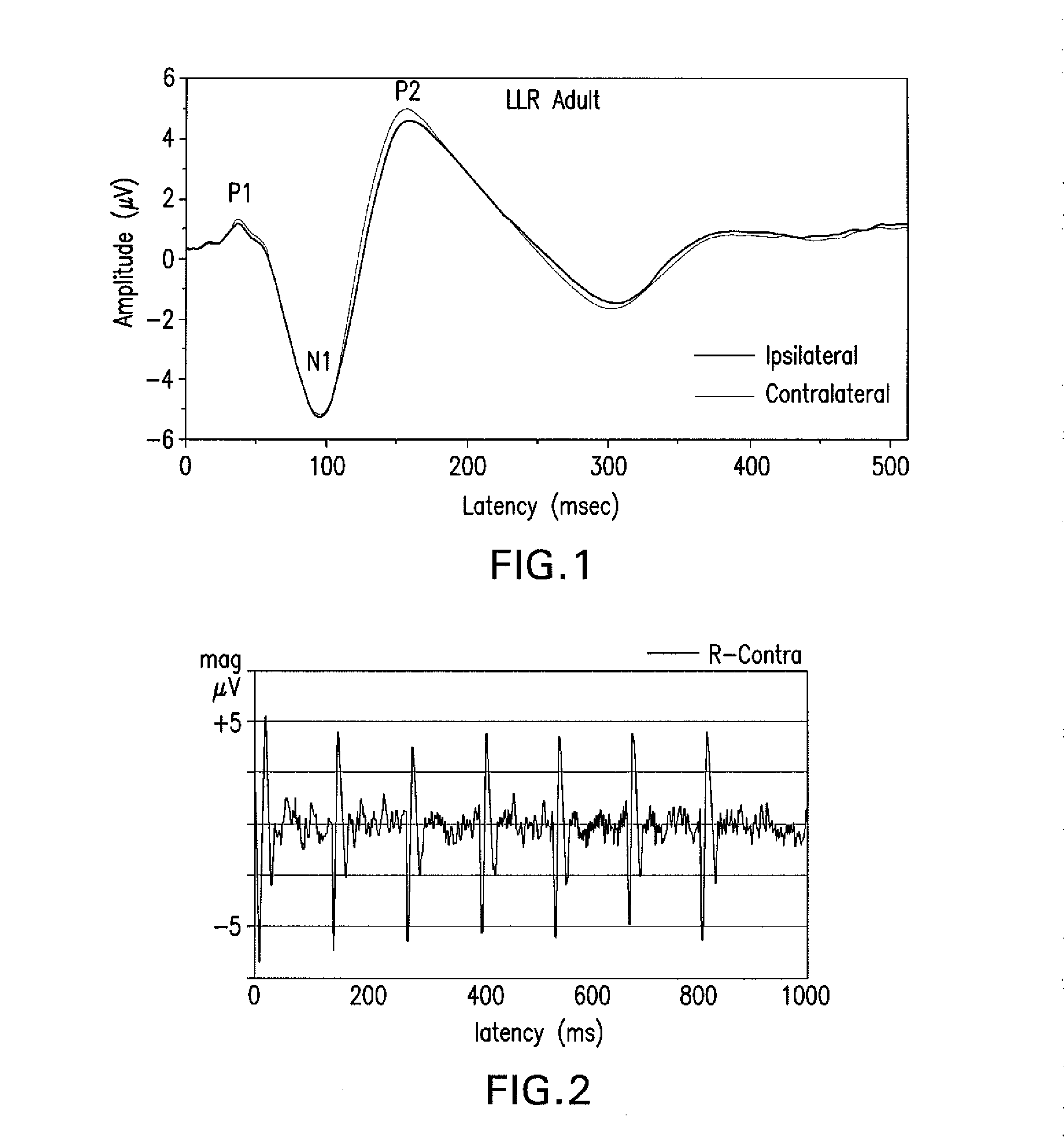 Steady state measurement and analysis approach to profiling auditory evoked potentials from short-latency to long latency