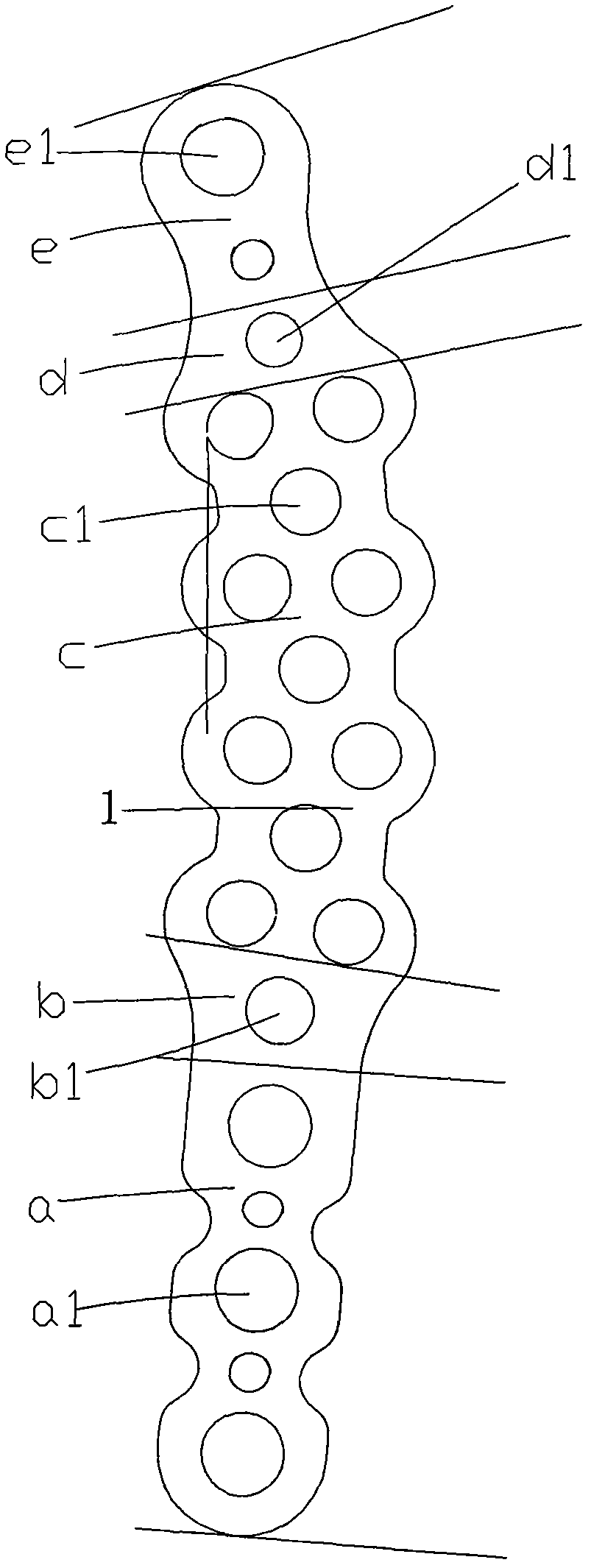 Self-locking acetabular posterior-wall posterior-column anatomical steel plate