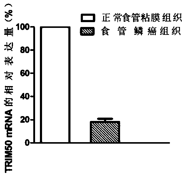 Application of trim50 in the diagnosis and treatment of esophageal squamous cell carcinoma