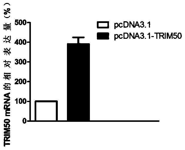 Application of trim50 in the diagnosis and treatment of esophageal squamous cell carcinoma