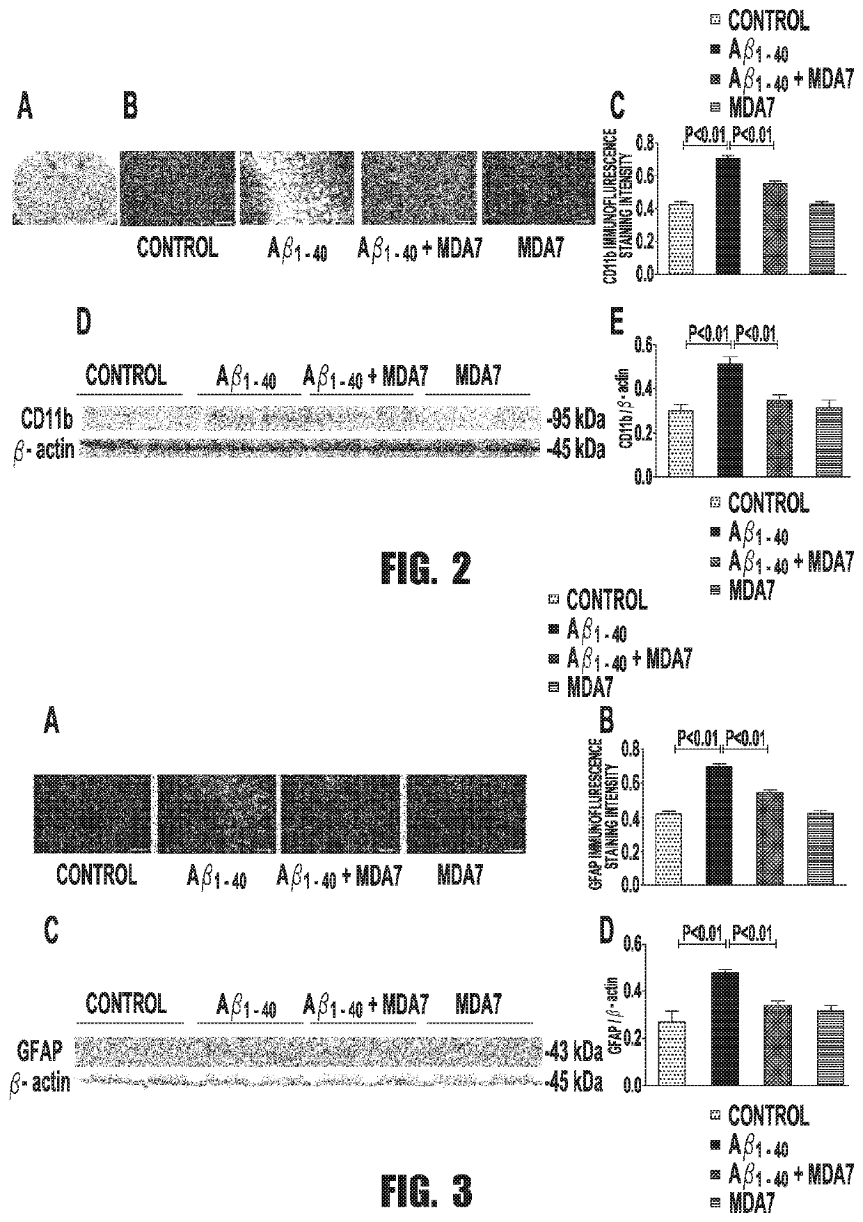 Neuroprotective cb2 receptor agonists