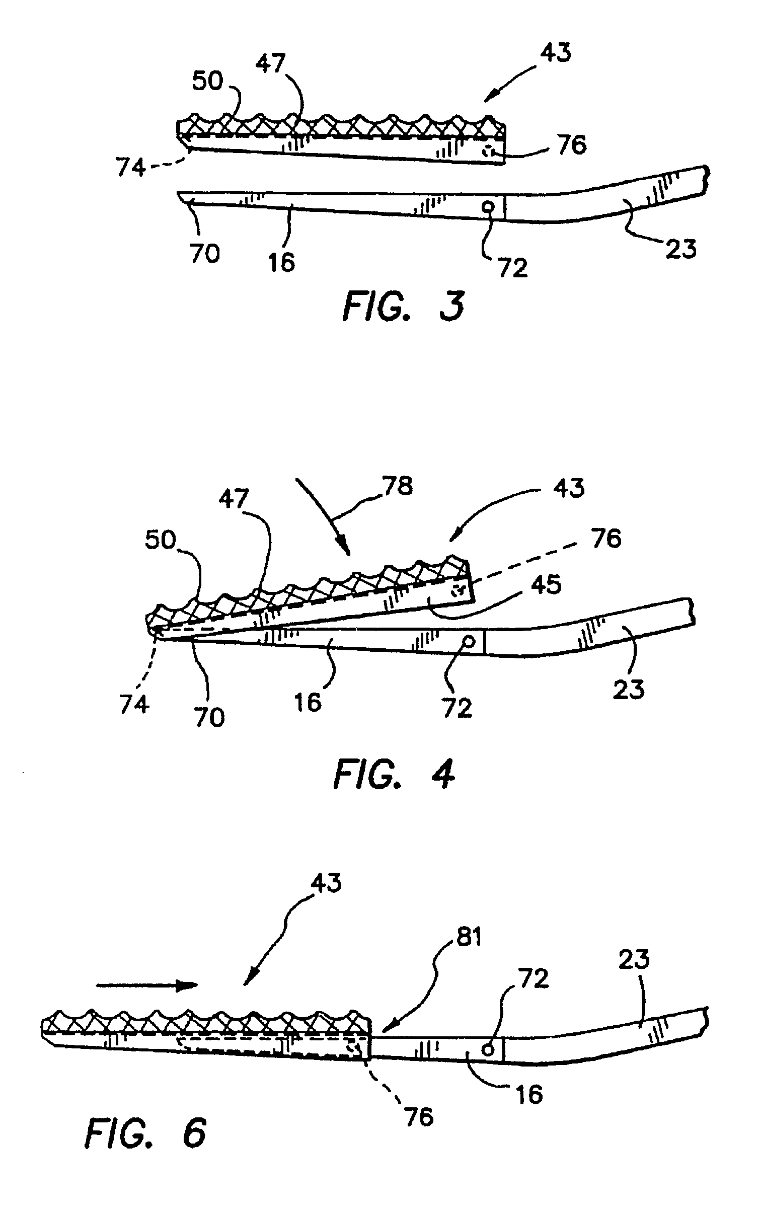 Peripheral vascular occlusion devices