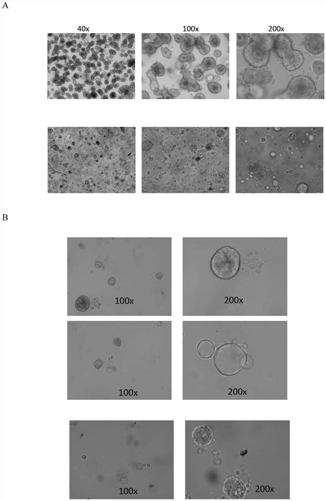 Construction method of bocavirus small intestine epithelium organoid infection model