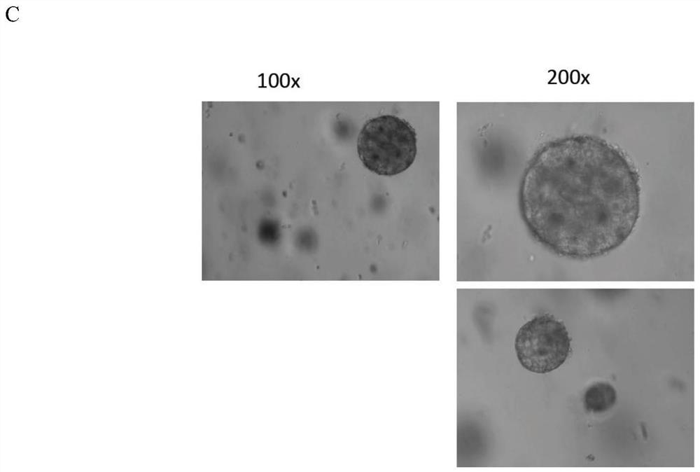 Construction method of bocavirus small intestine epithelium organoid infection model