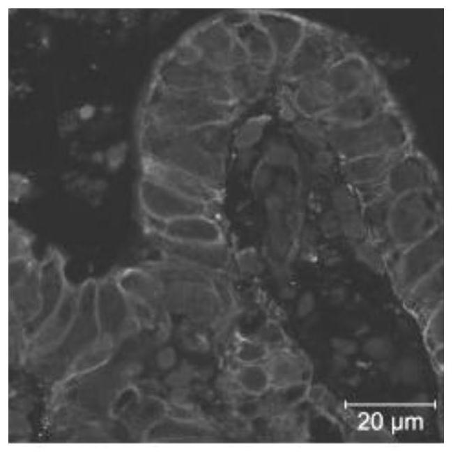 Construction method of bocavirus small intestine epithelium organoid infection model