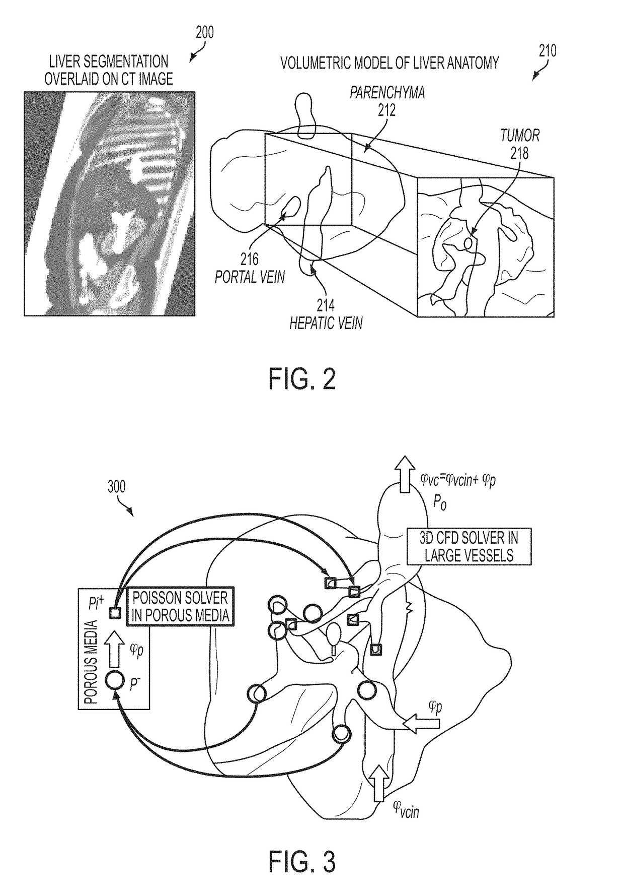 System and method for patient specific modeling of liver tumor ablation