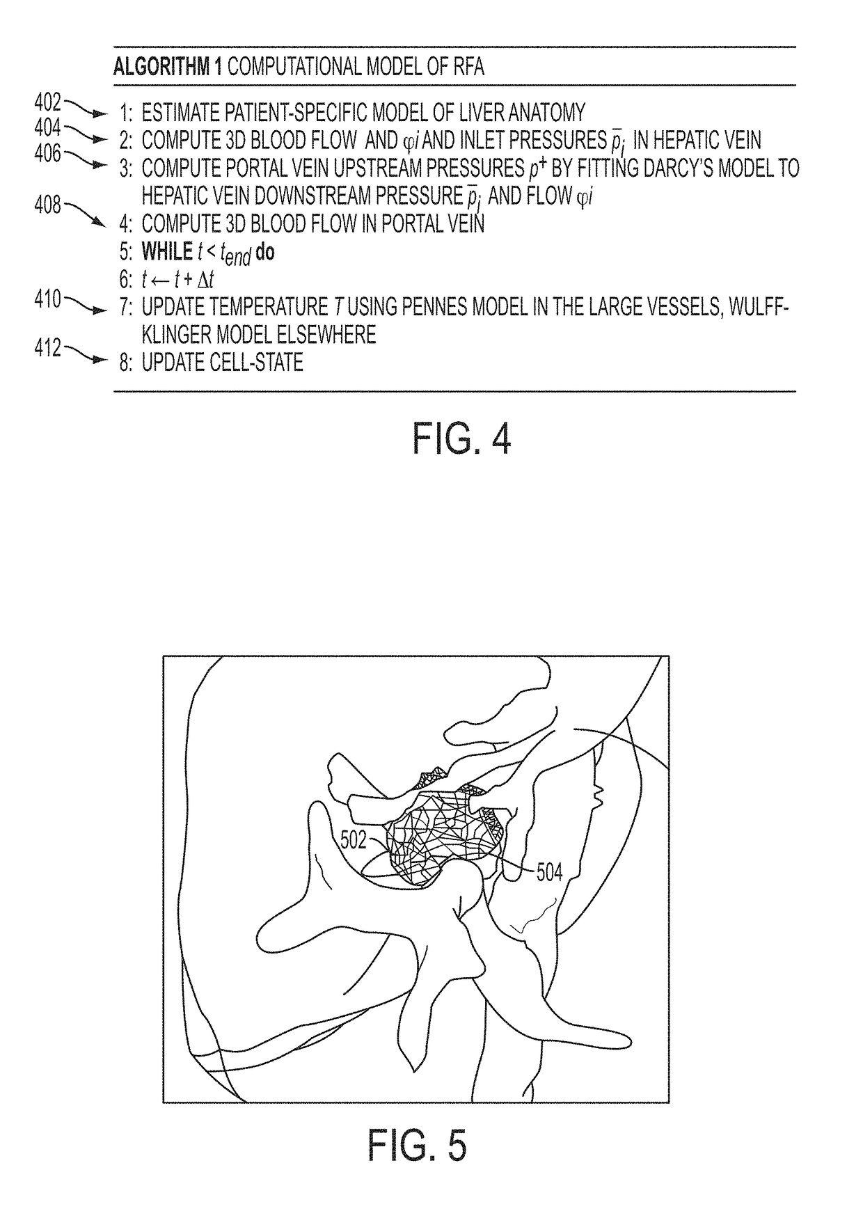 System and method for patient specific modeling of liver tumor ablation