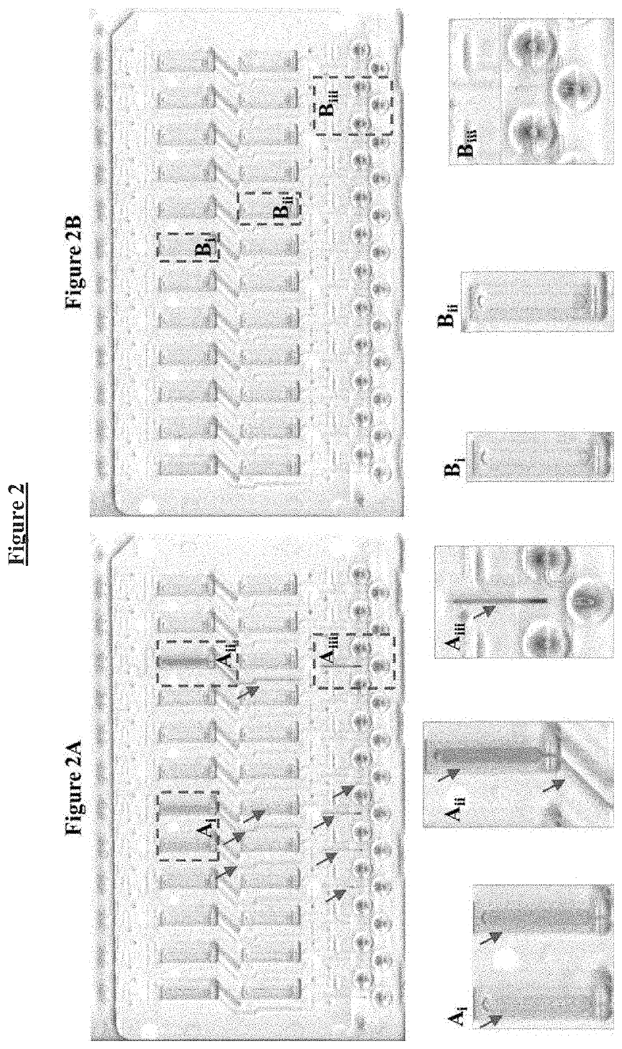 Buffer compositions for reducing aggregation