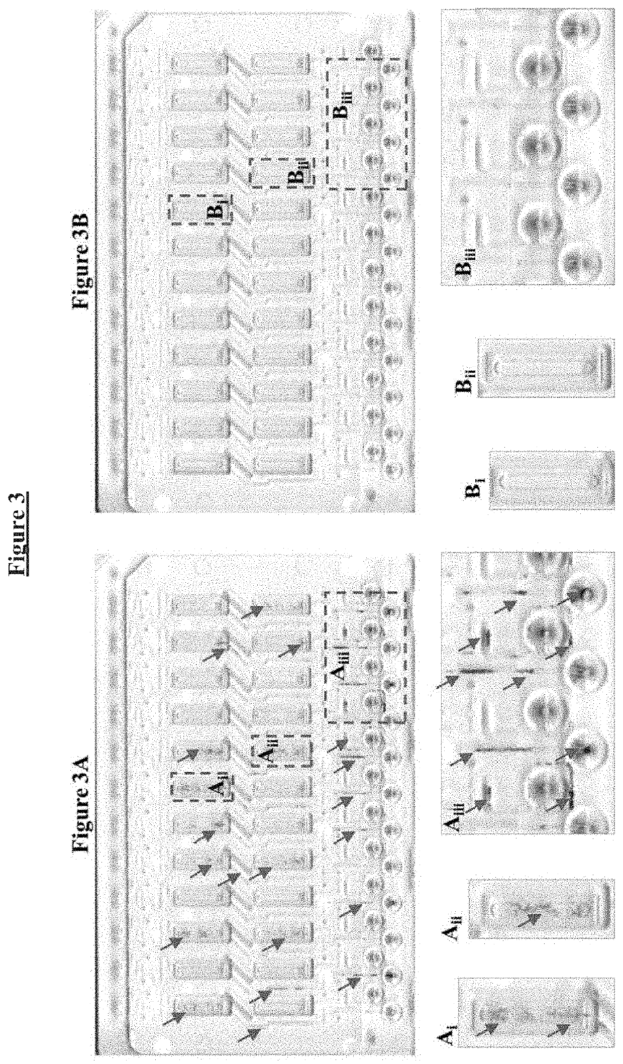 Buffer compositions for reducing aggregation