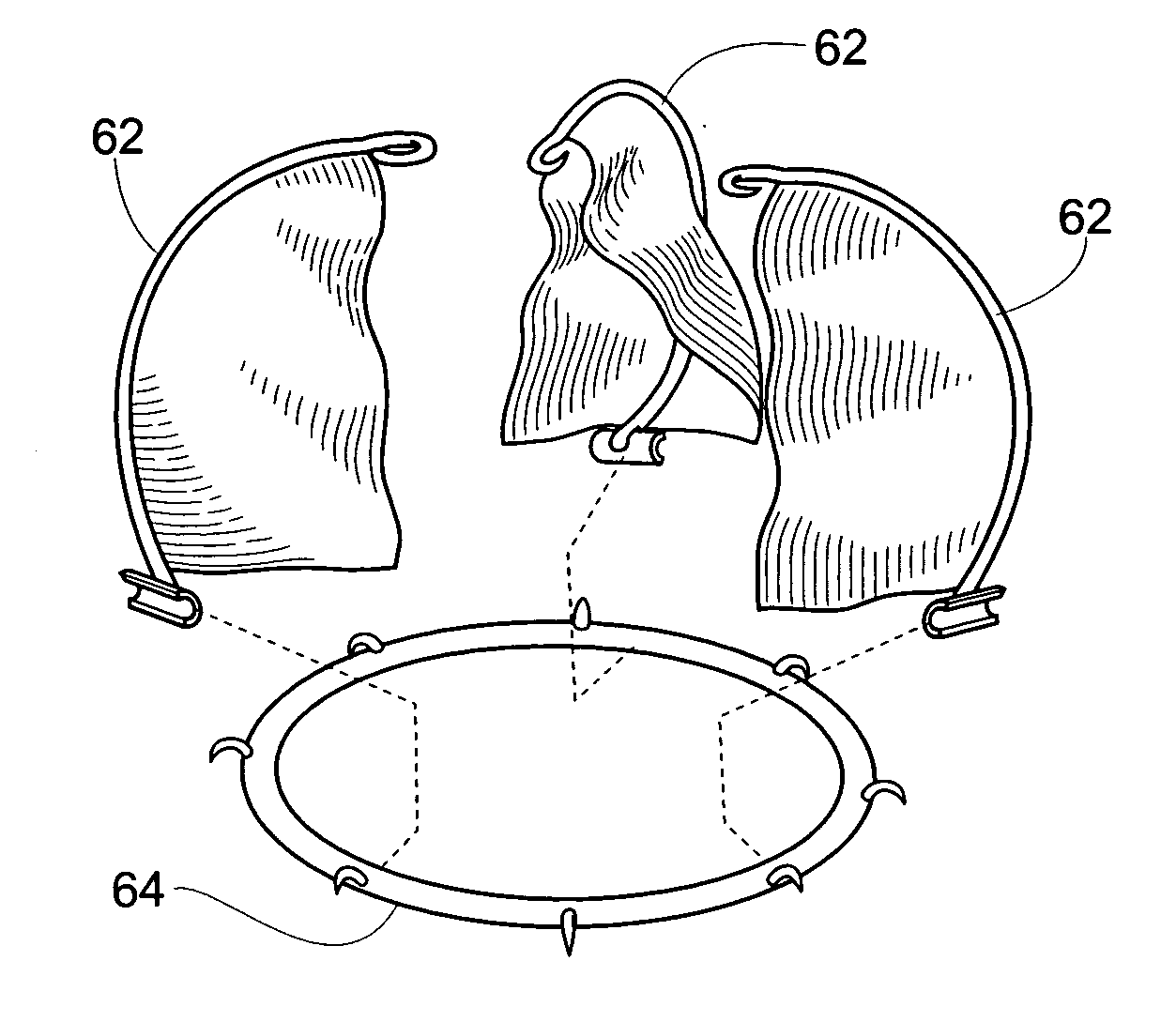 Suspended heart valve devices, systems, and methods for supplementing, repairing, or replacing a native heart valve