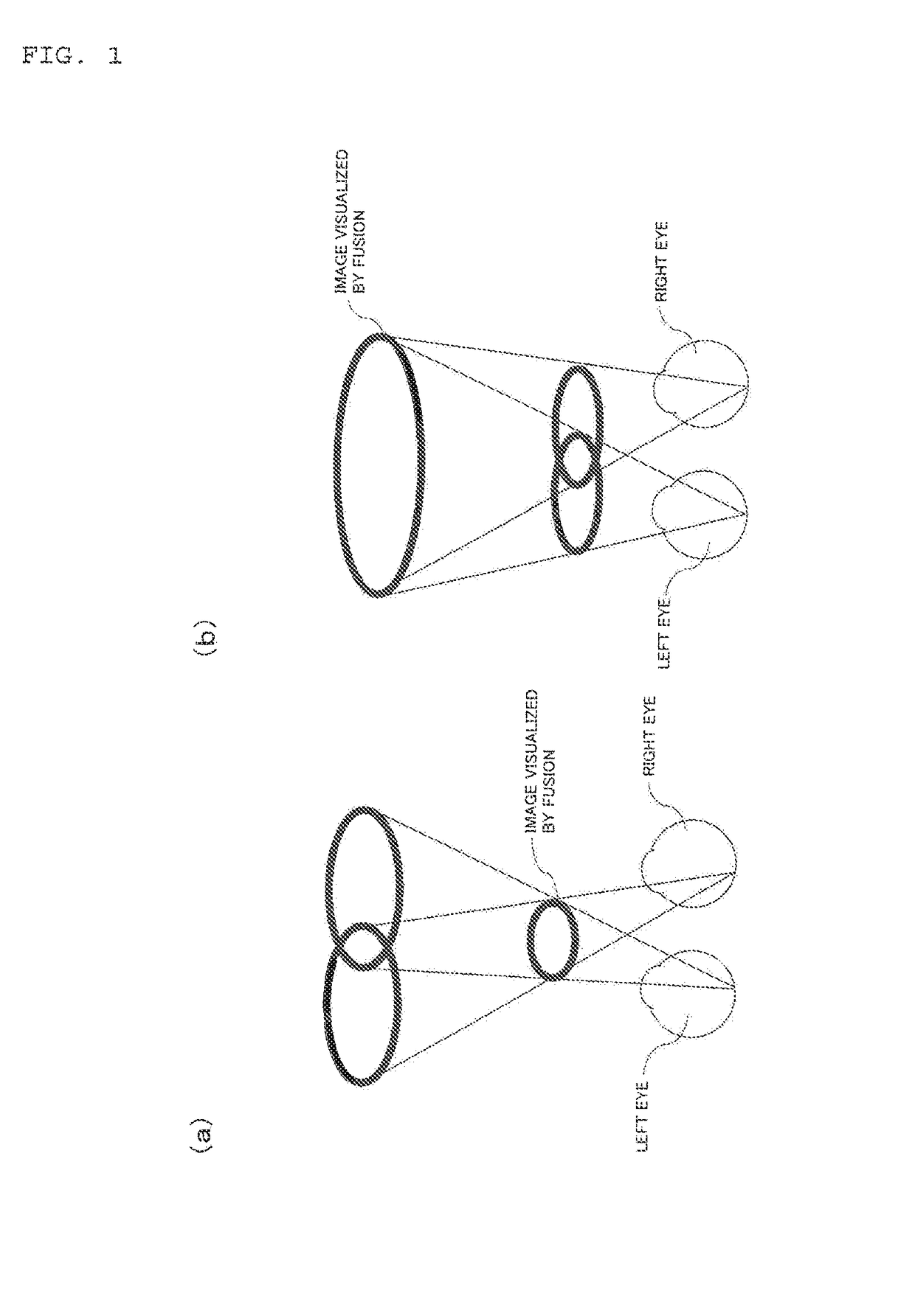 Pair of spectacle lenses for binocular vision, manufacturing method, supply system and supply program thereof