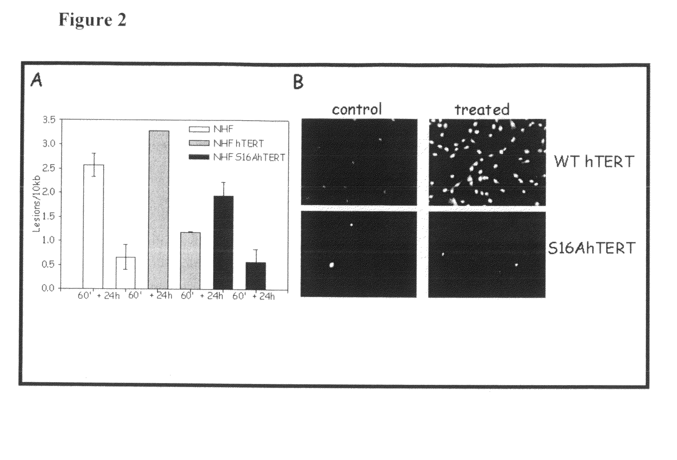 Nuclear telomerase reverse transcriptase variant