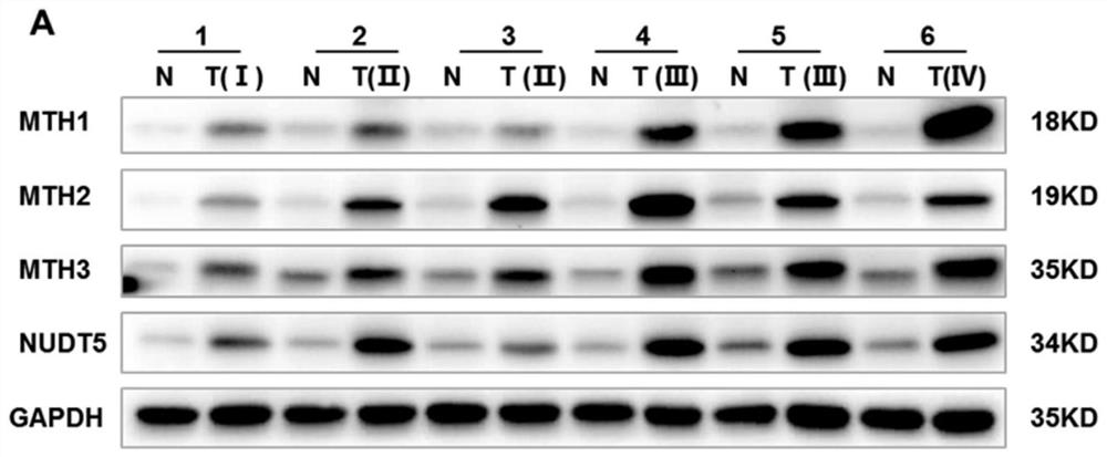 A marker for judging the prognosis of colorectal cancer and its application