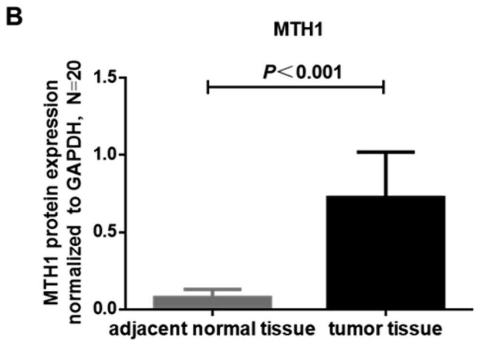 A marker for judging the prognosis of colorectal cancer and its application