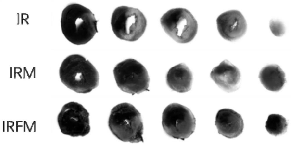 Application of temperature-sensitive hydrogel packaging mitochondria