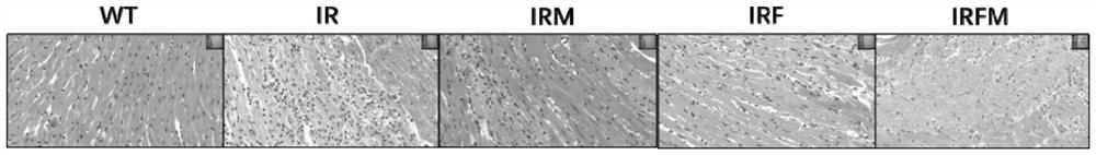 Application of temperature-sensitive hydrogel packaging mitochondria