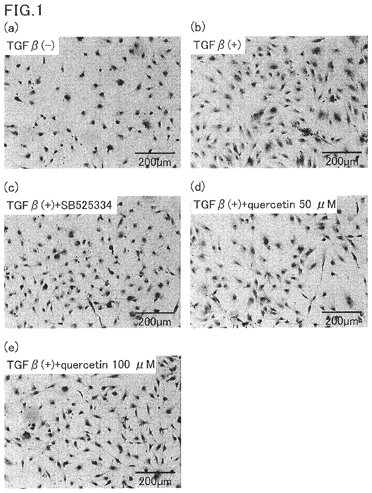 Composition for inhibiting myofibrosis