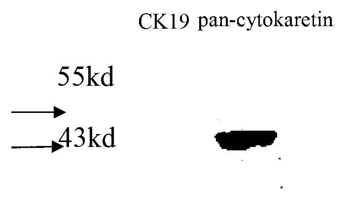 Method for expanding pancreatic beta cell in vitro