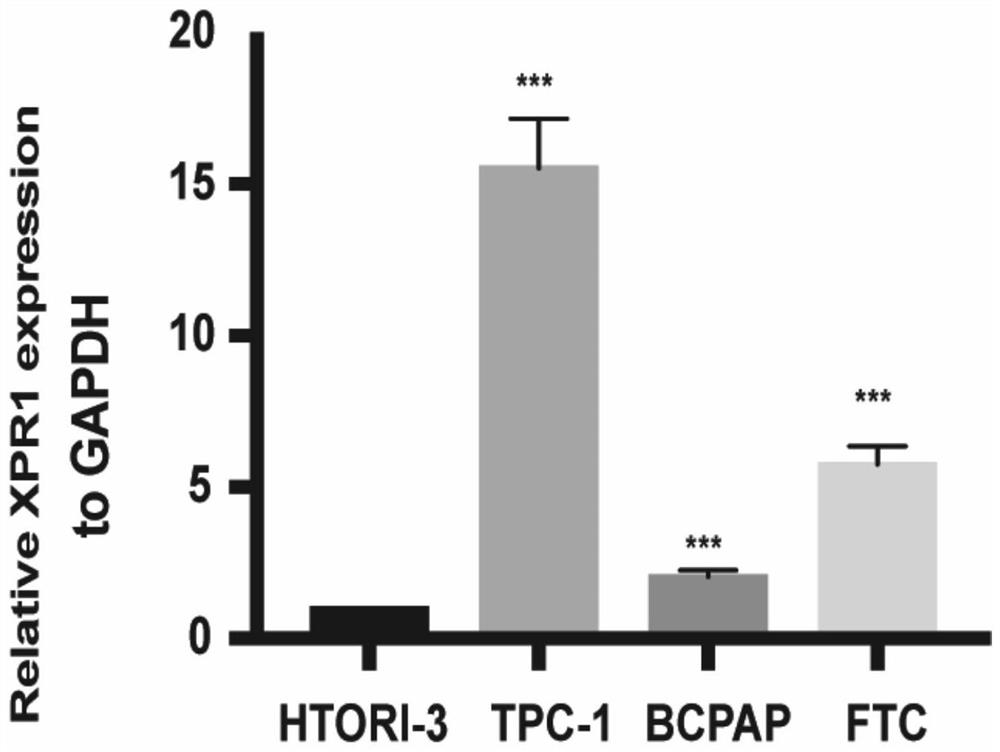 Application of XPR1 inhibitor in preparation of product for inhibiting migration and/or proliferation of thyroid cancer cells