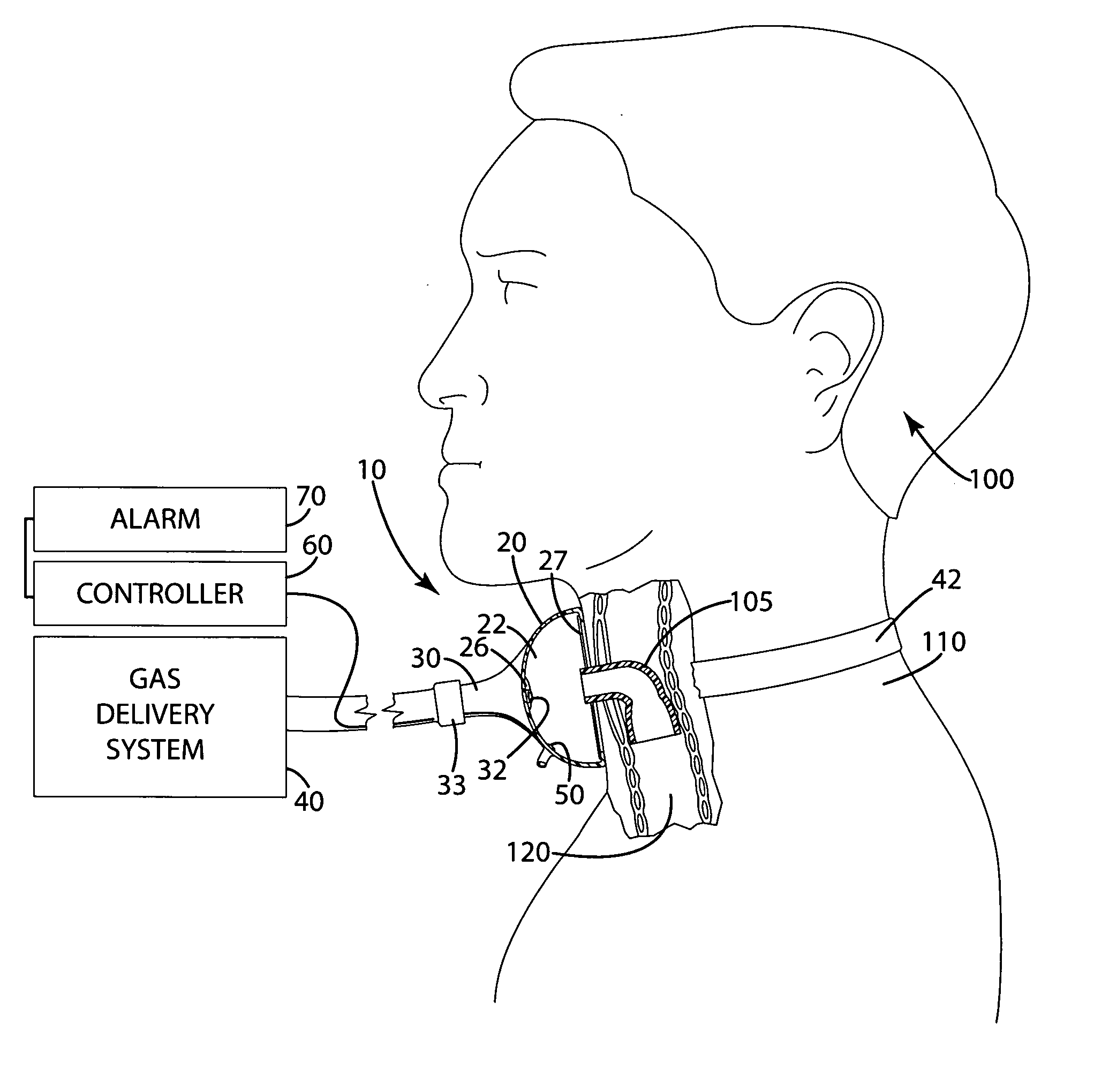 Respiratory monitoring apparatus and related method