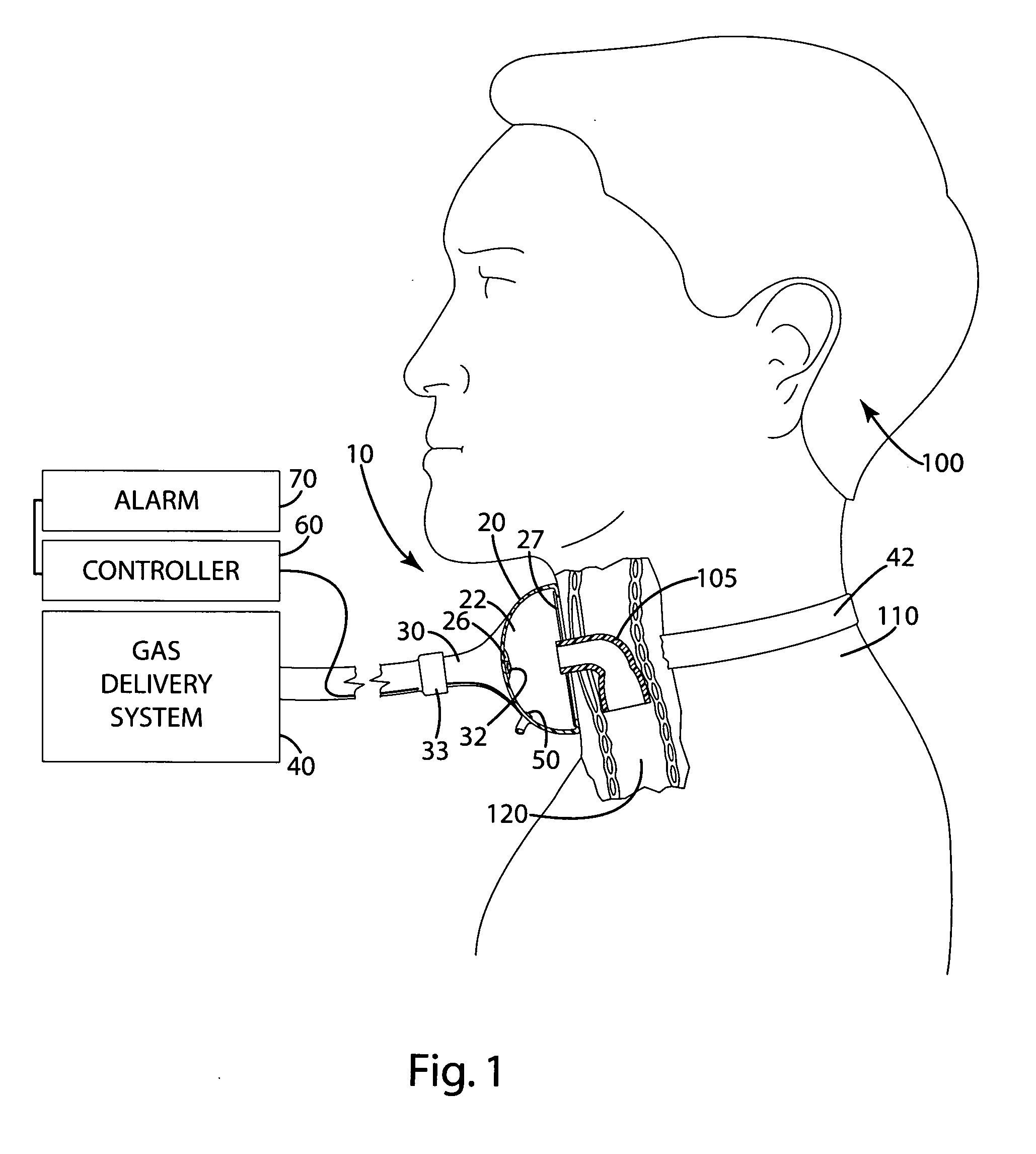 Respiratory monitoring apparatus and related method