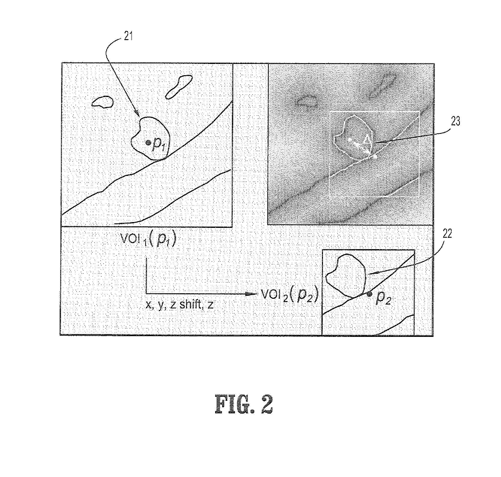 System and Method For Image-Based Tree Matching And Registration