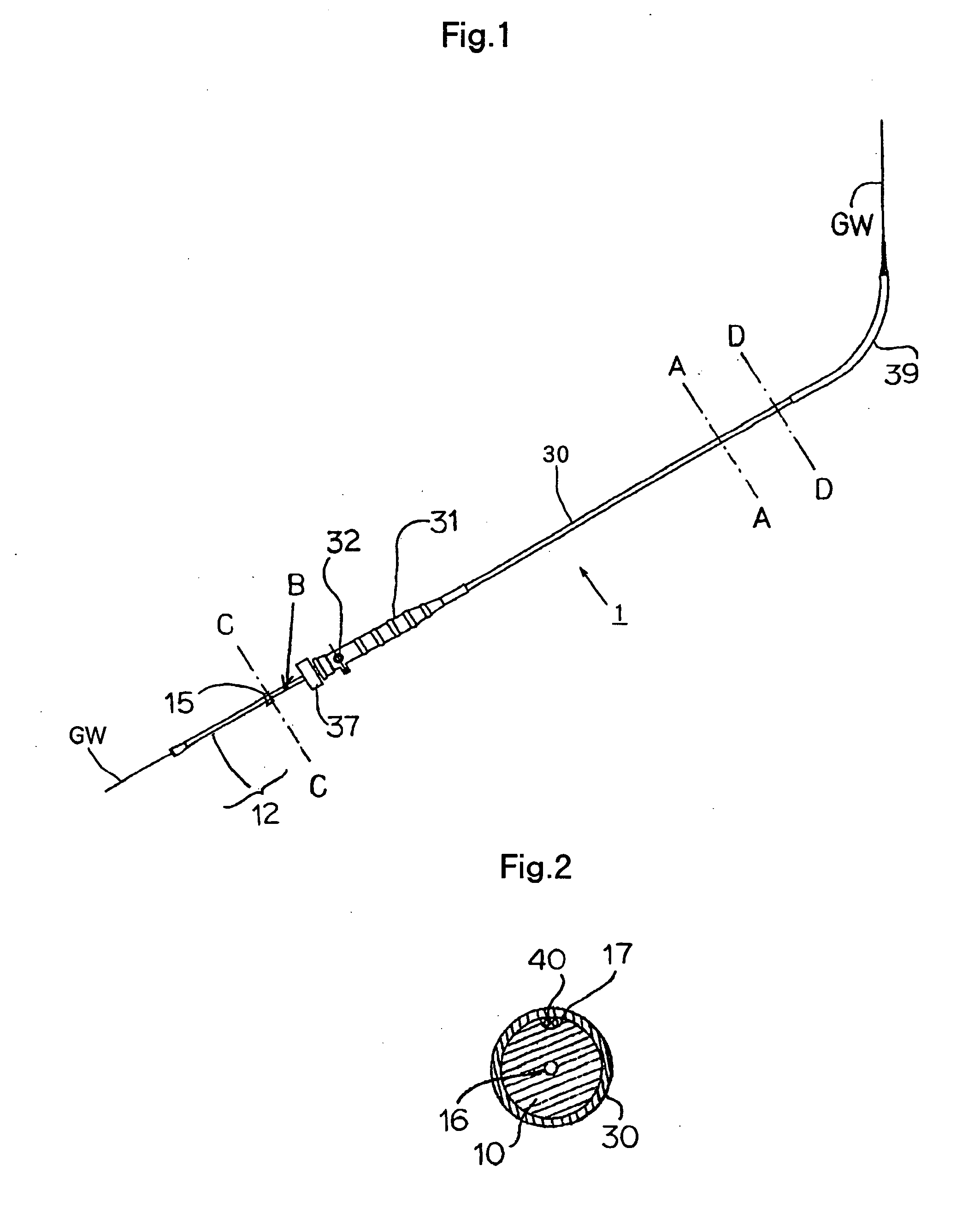Stent Graft Indwelling Device And Fixed Chip