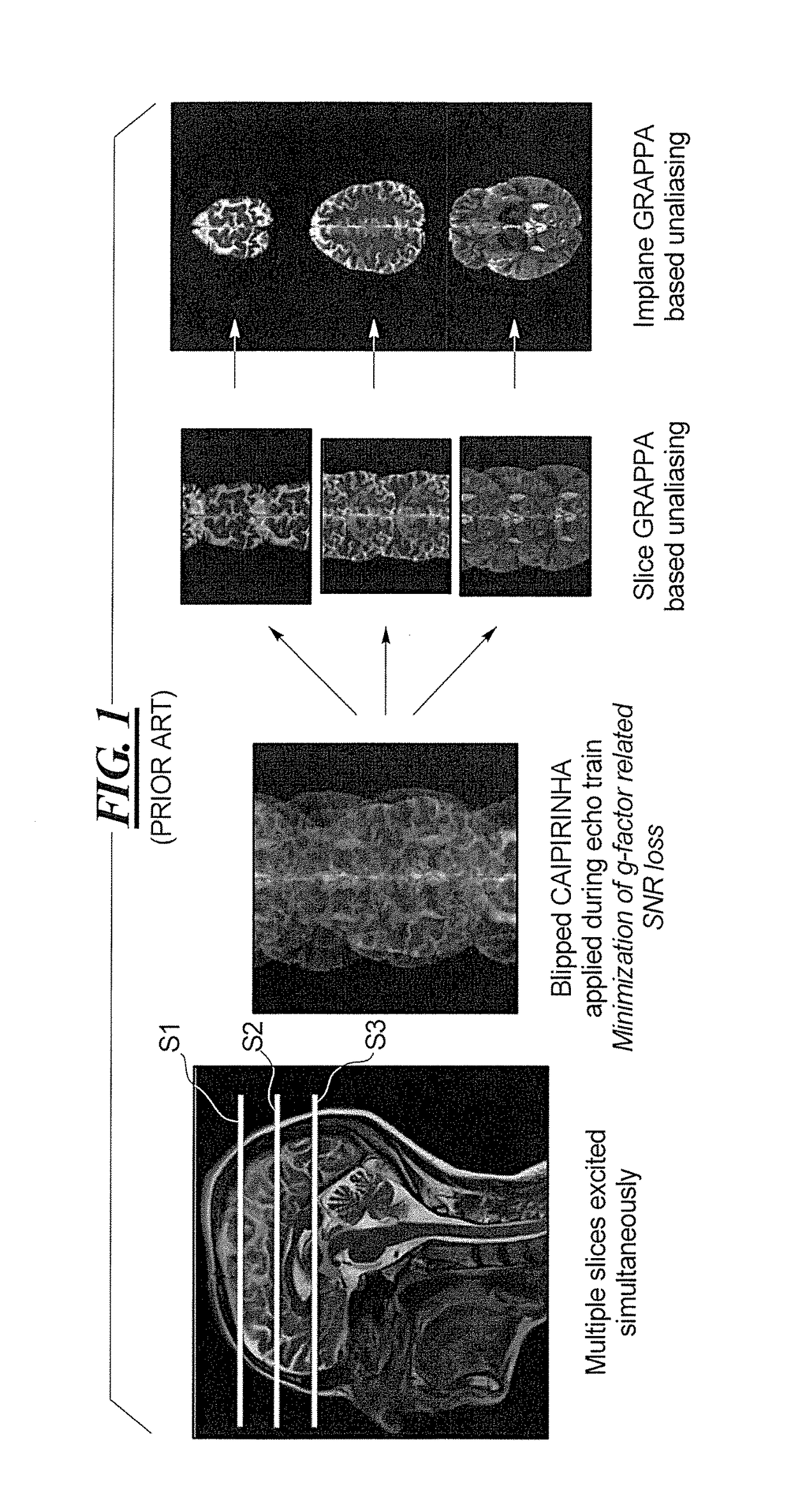 Multi-contrast simultaneous multislice magnetic resonance imaging with binomial radio-frequency pulses