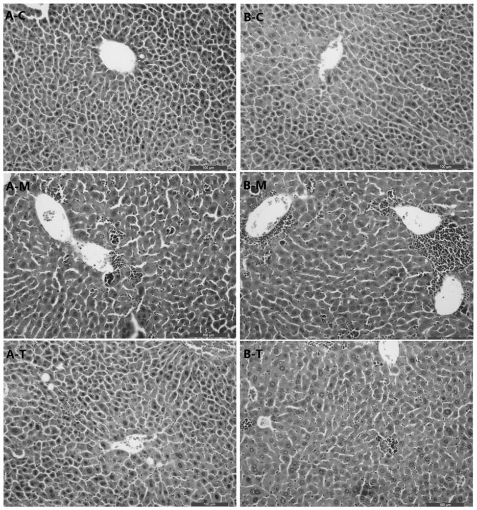 Traditional Chinese medicine composition, preparation method and application thereof in preparation of medicine for treating liver injury