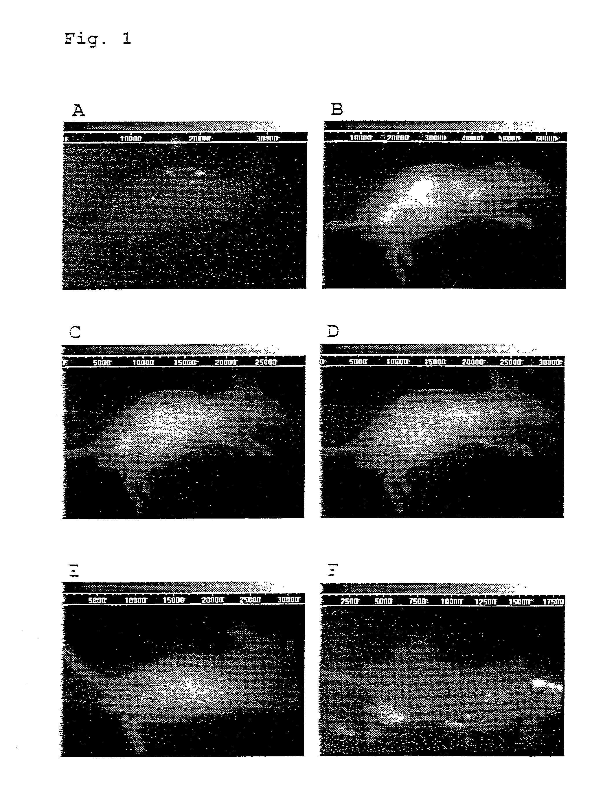 In-vivo diagnostic method by means of near infrared radiation