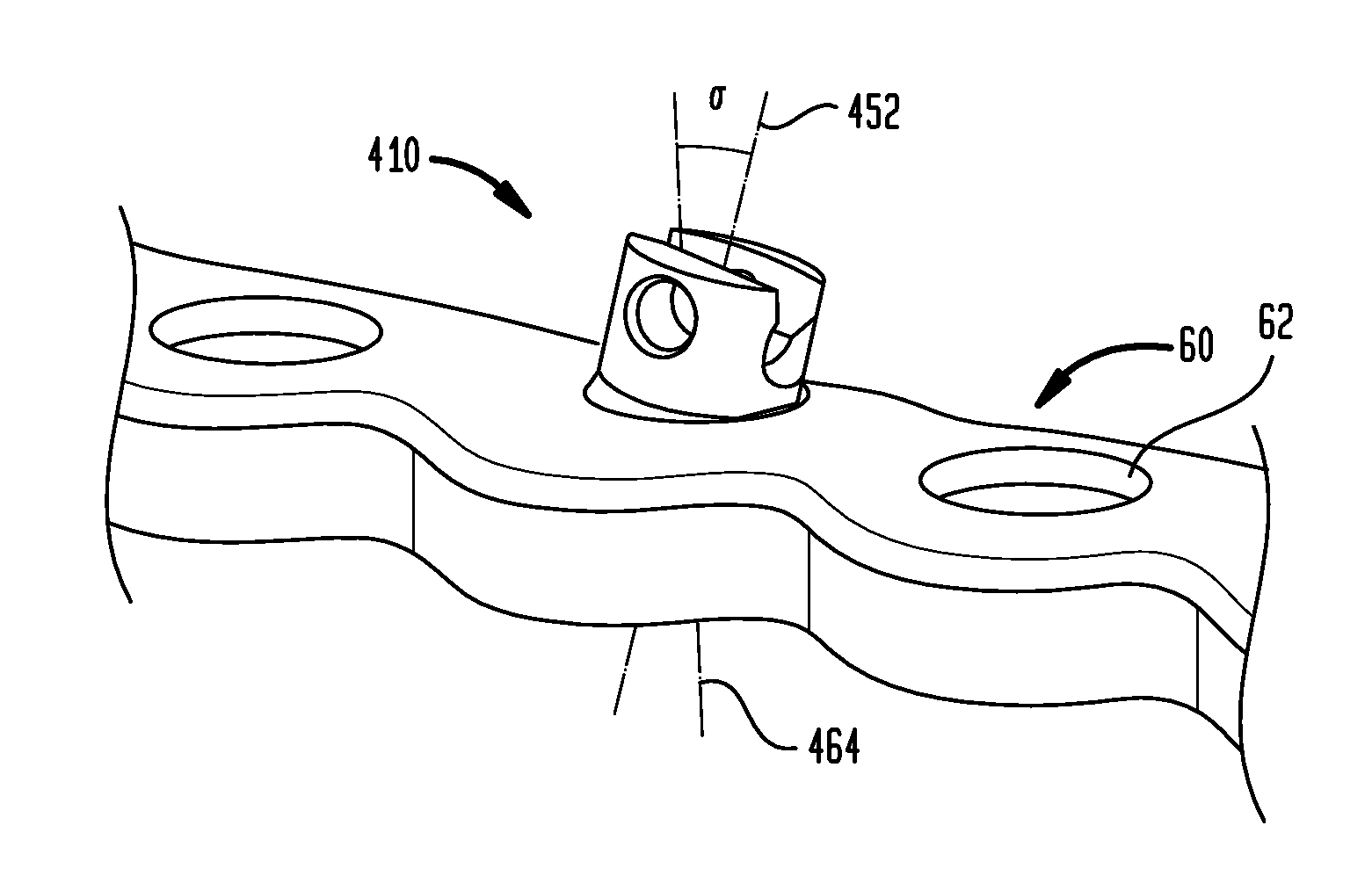 Cable plugs for bone plates