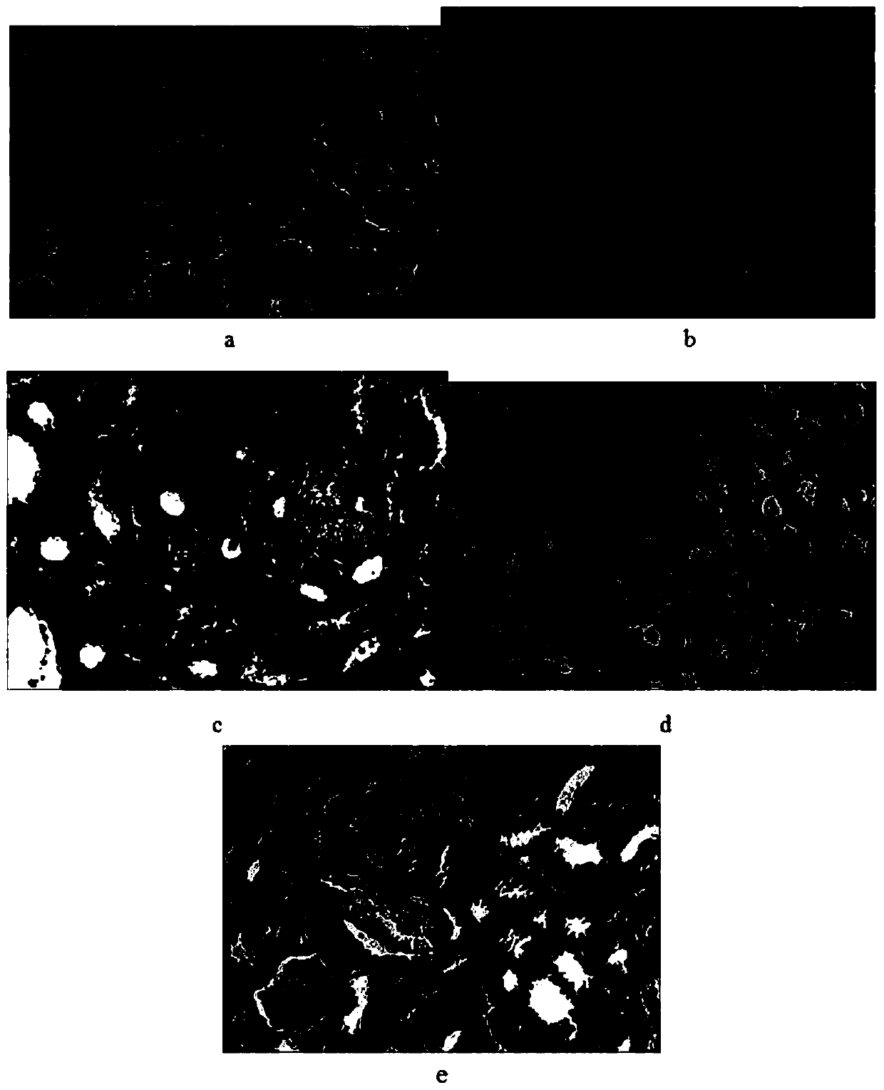 Application and preparation method of Hovenia dulcis bark extract in preparation of medicine for treating kidney stones