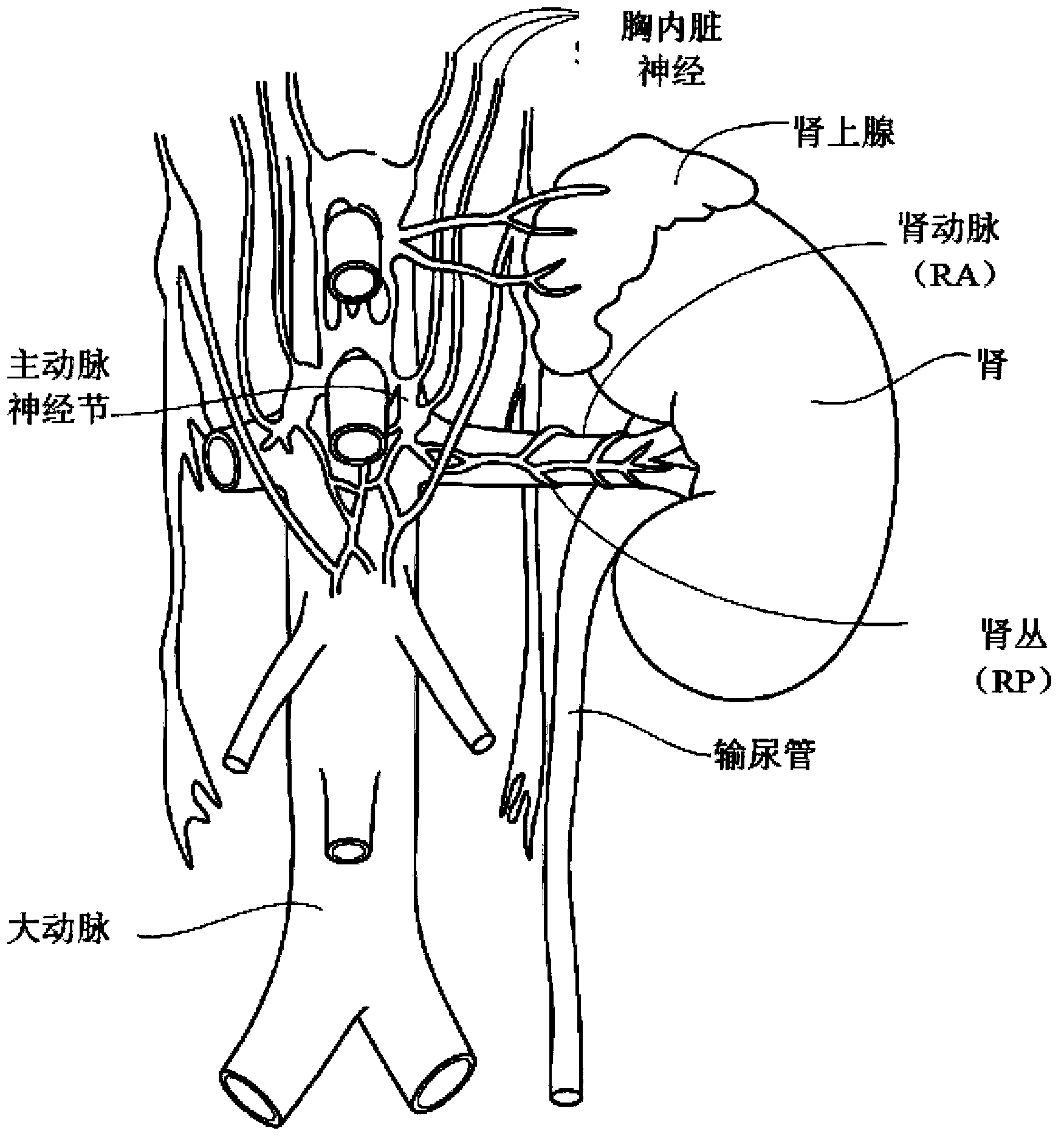 Cryoablation apparatuses, systems, and methods for renal neuromodulation