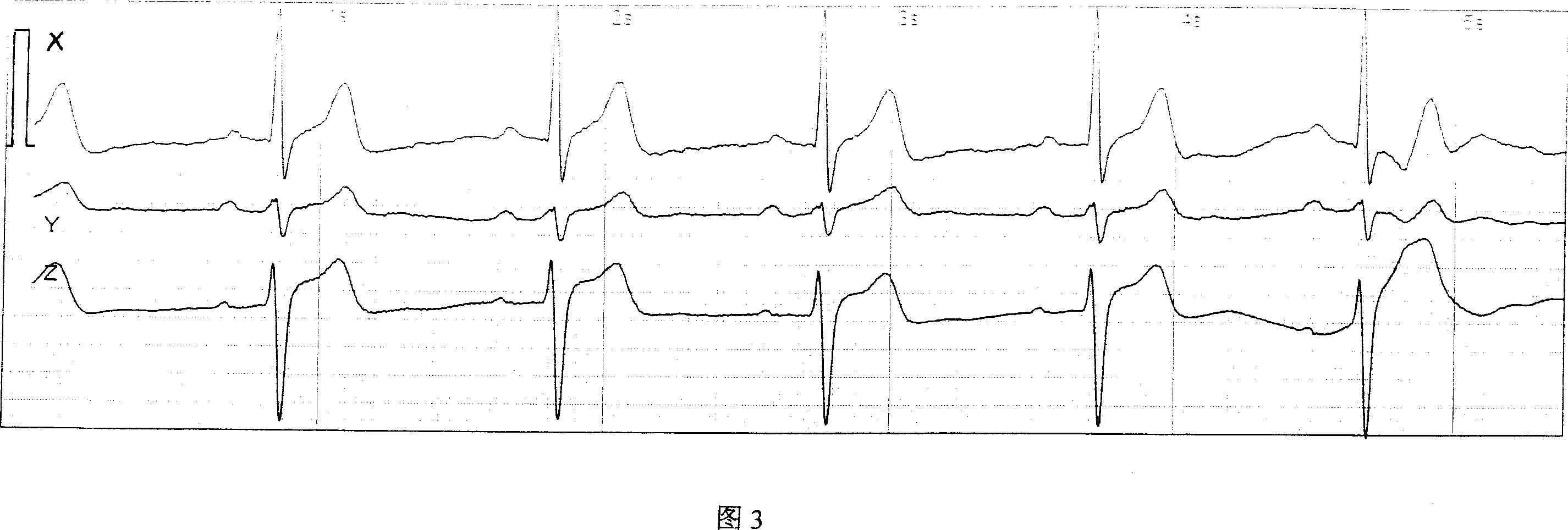 Electrocardiograph with three-dimensional image and method for implementing same