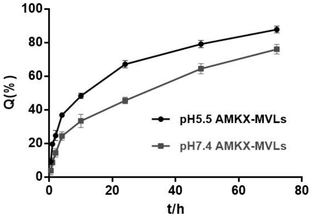 Amikacin sulfate multivesicular liposome for local injection and preparation method of amikacin sulfate multivesicular liposome