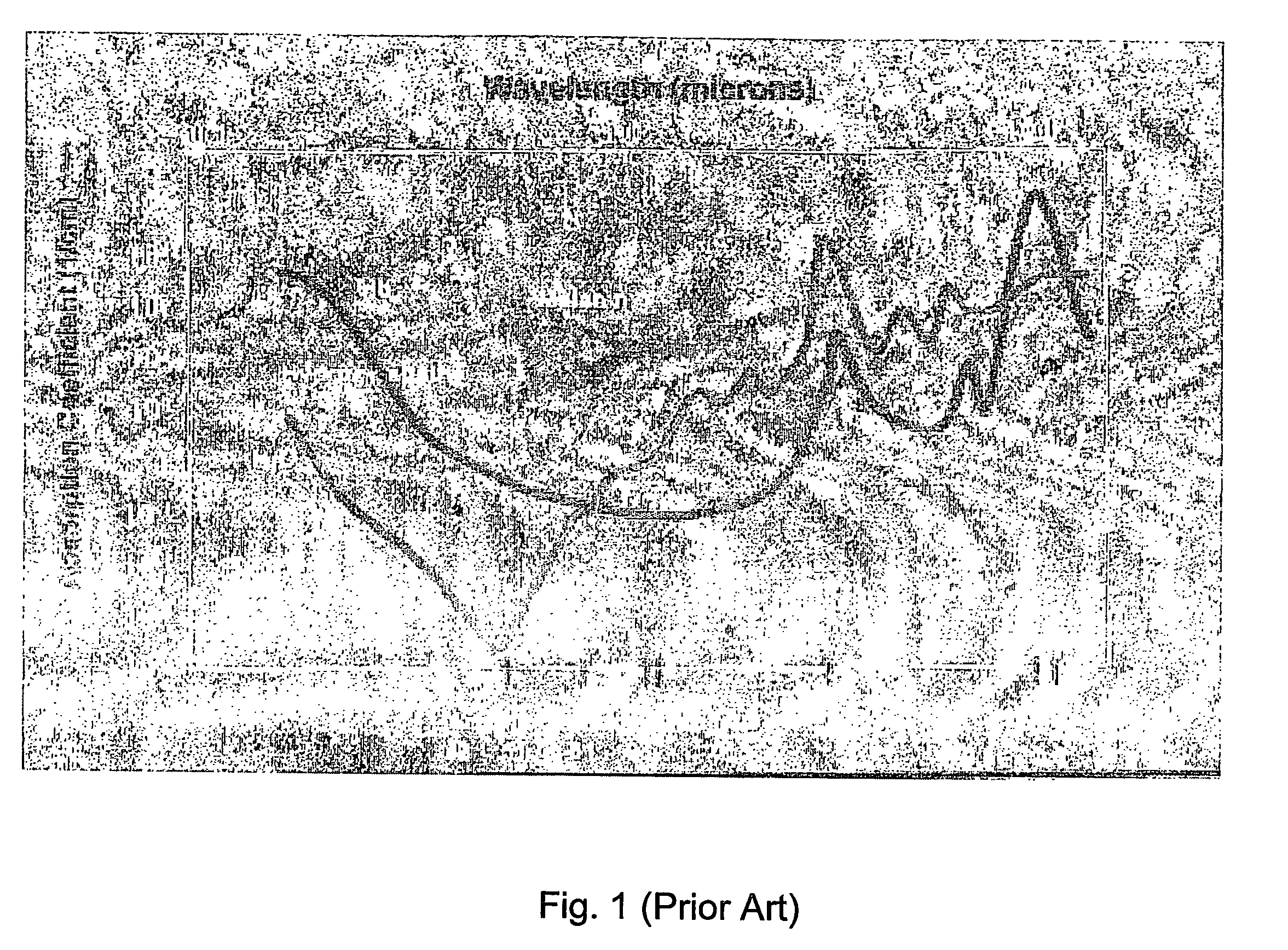 System,apparatus and method for large area tissue ablation