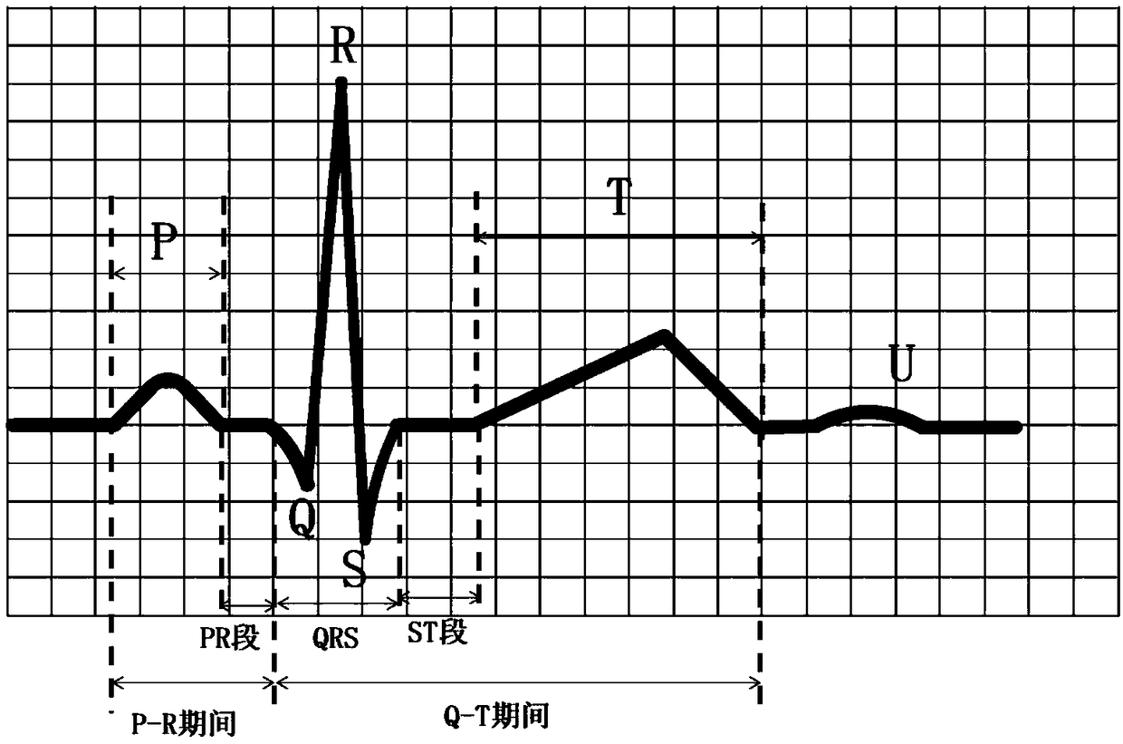 Ventricular premature beat recognition method, recognition system and electronic equipment